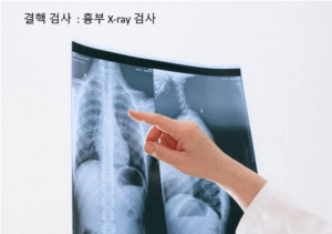 흉부 X-ray 사진